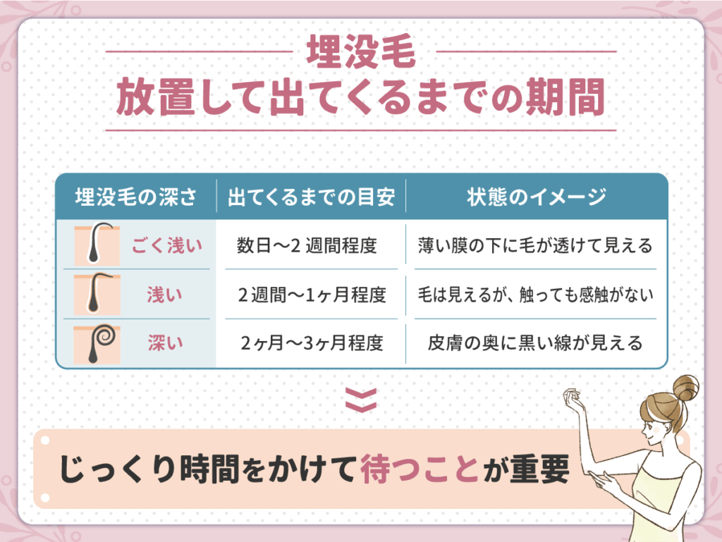 埋没毛を放置して出てくるまでの期間