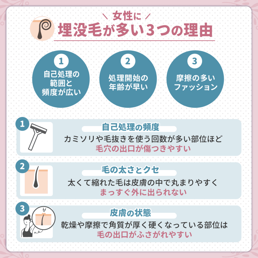 埋没毛ができやすい部位ランキングと女性に埋没毛が多い3つの理由