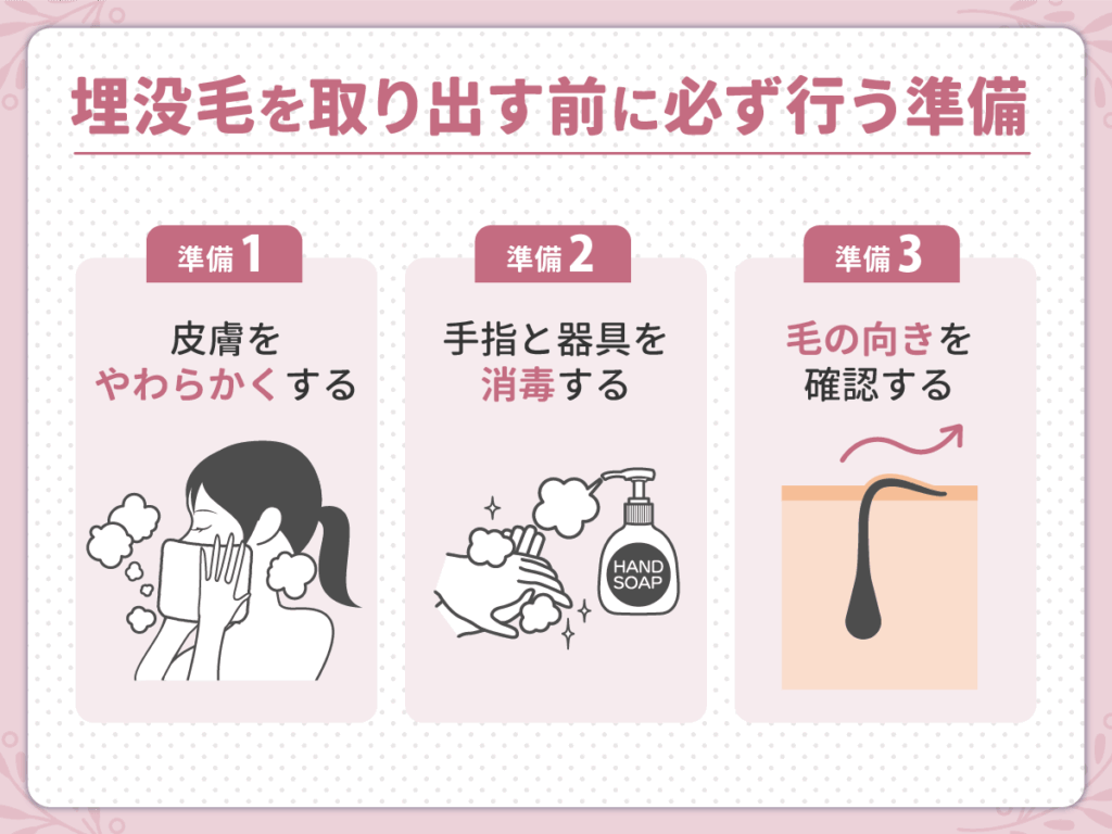 埋没毛を取り出す前に必ず行う準備