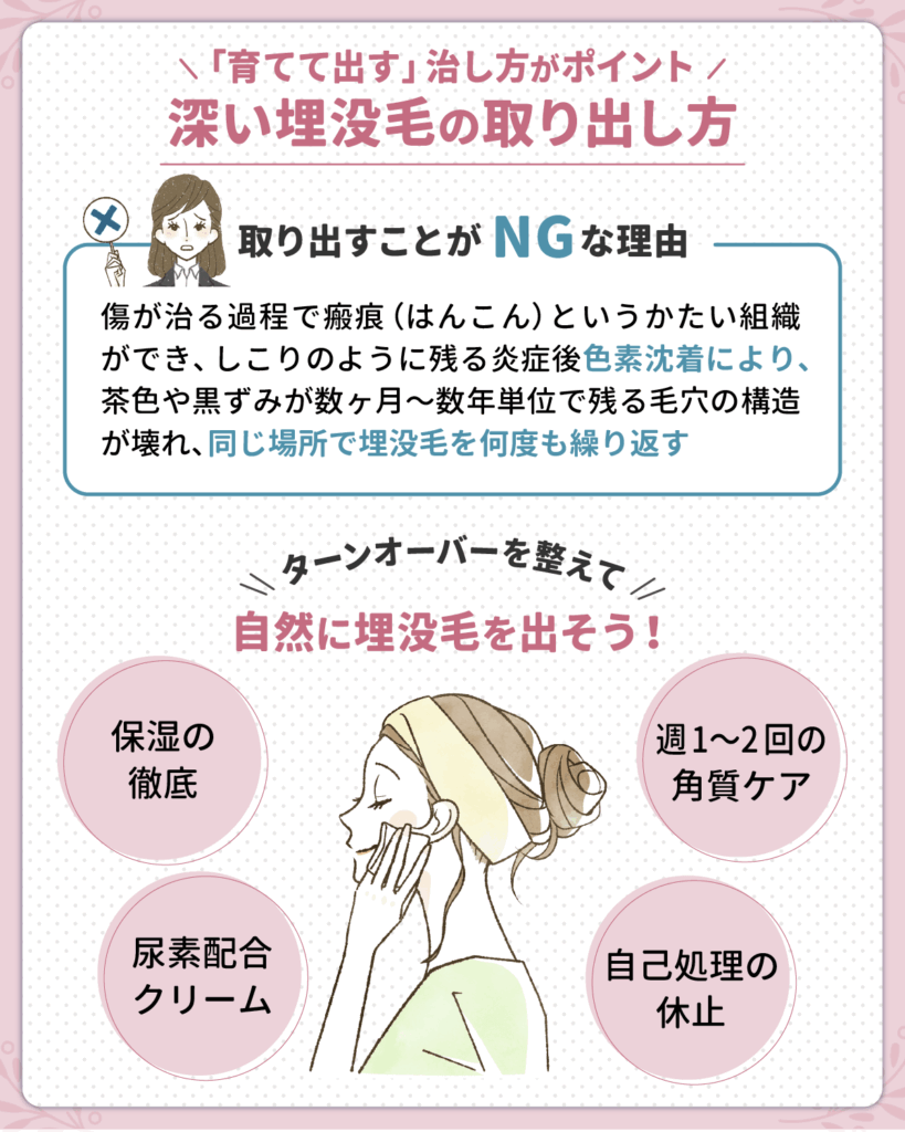 深い埋没毛の取り出し方は掘らずに「育てて出す」治し方がポイント