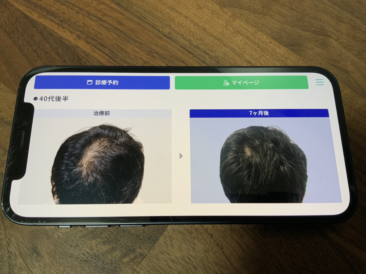 DMM AGA クーポン 奨励写真